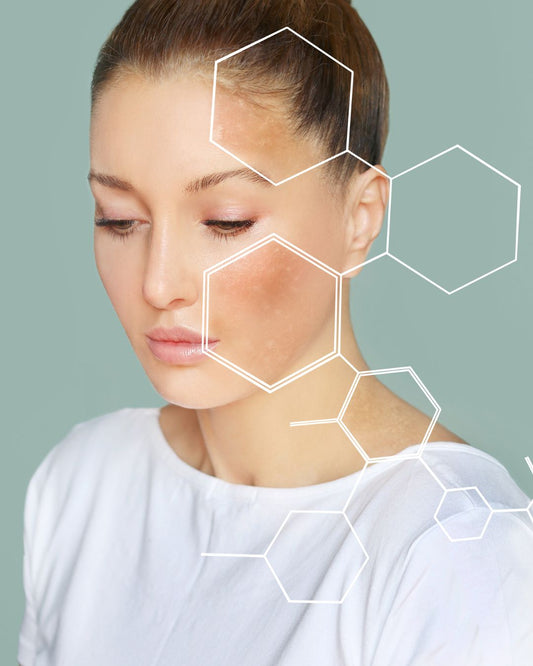 Routine peau sensible en hiver : erreurs à éviter, conseils experts et soins hydratants clean pour apaiser et protéger la peau.